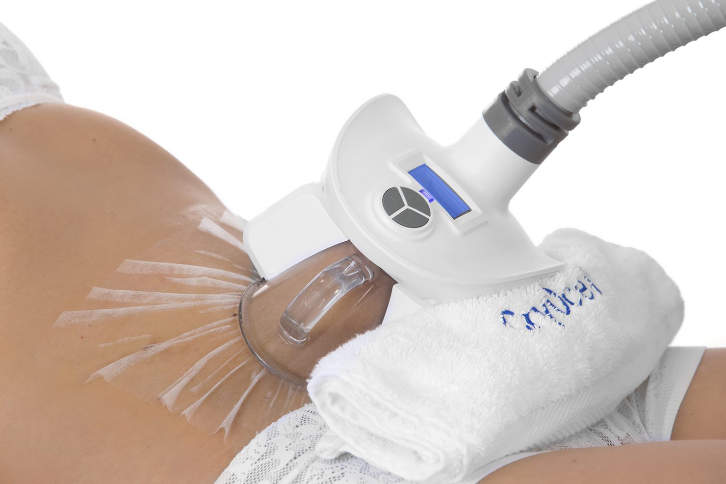 abdomen serviette cryocell